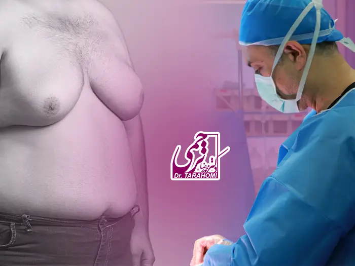 بهترین جراح ژنیکوماستی