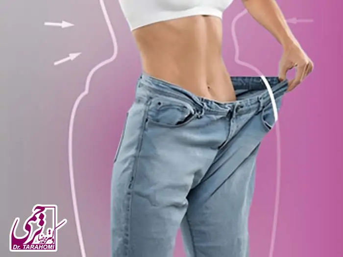 رابطه جنسی بعد ابدومینوپلاستی