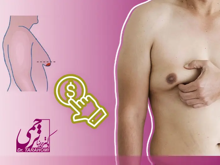 قیمت ژنیکوماستی