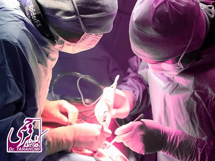 مرگ در اثر ابدومینوپلاستی