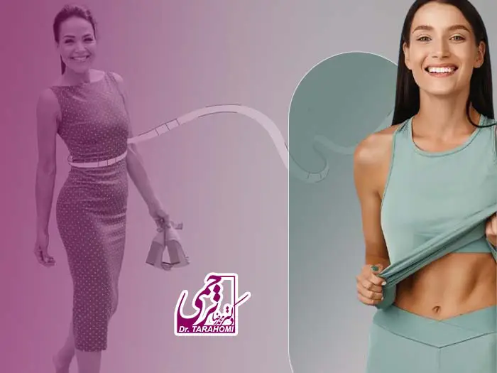 نزدیکی بعد ابدومینوپلاستی