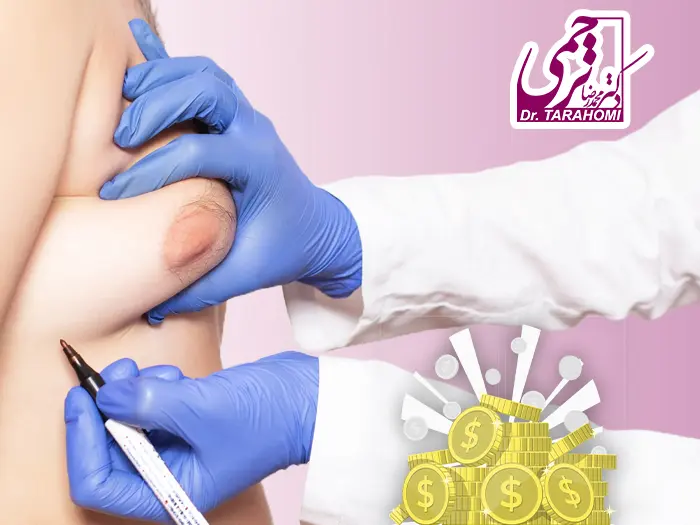 هزینه ژنیکوماستی