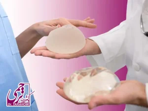 انواع مختلف پروتز سینه