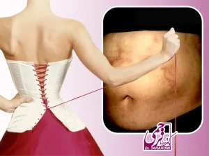 خطرات پیکرتراشی