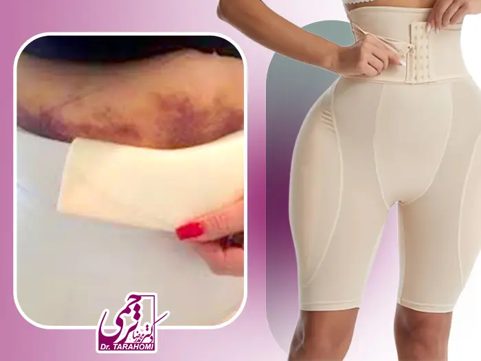 عوارض پیکرتراشی