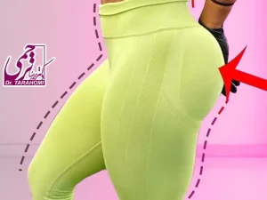 لیفت باسن برزیلی