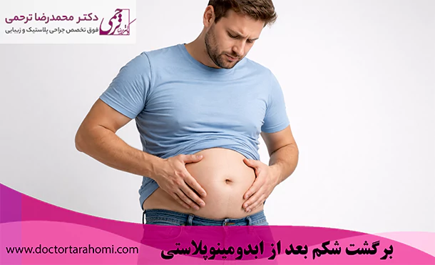 برگشت شکم بعد از ابدومینوپلاستی برگشت شکم بعد از ابدومینوپلاستی
