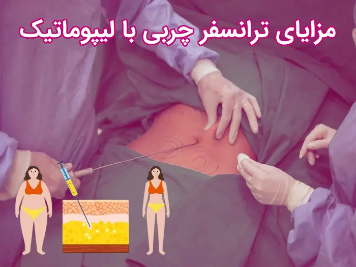 ترانسفر چربی