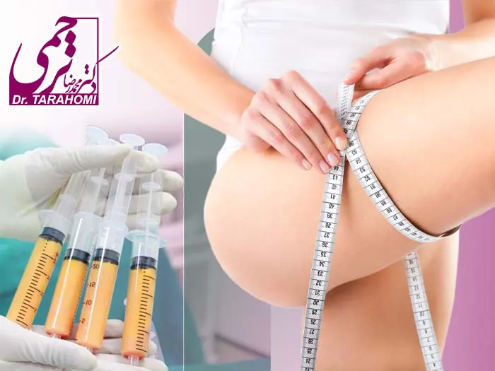 تزریق چربی به ران پا