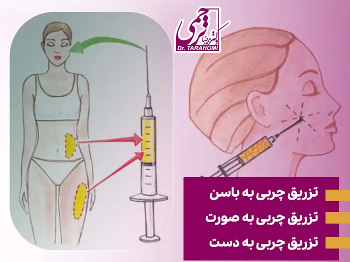 عمل ترانسفر