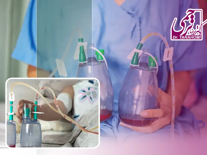 درن بعد عمل