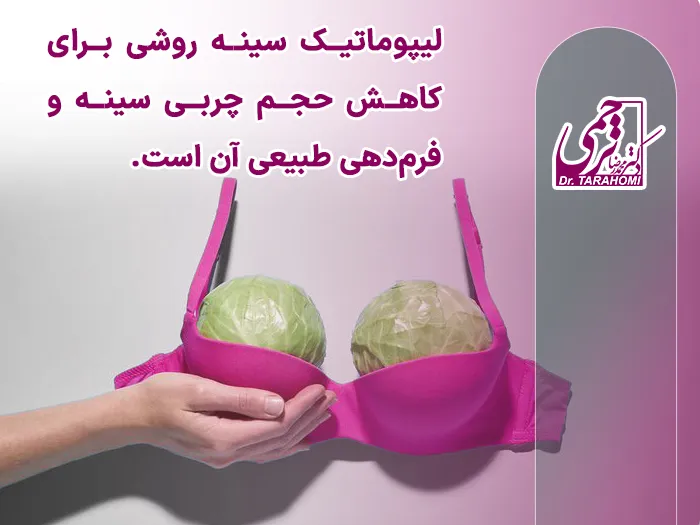 لیپوماتیک ناحیه سینه