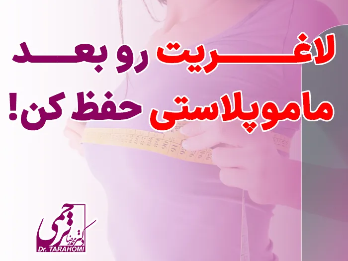 تناسب اندام بعد مامو.پلاستی