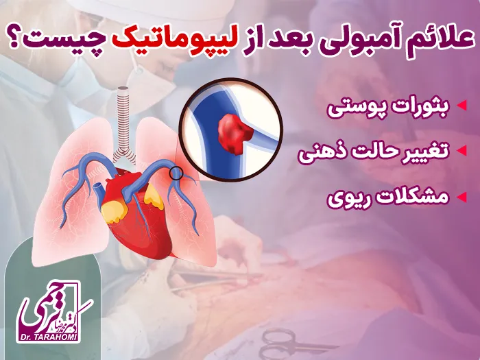 آمبولی بعد از عمل لیپوماتیک