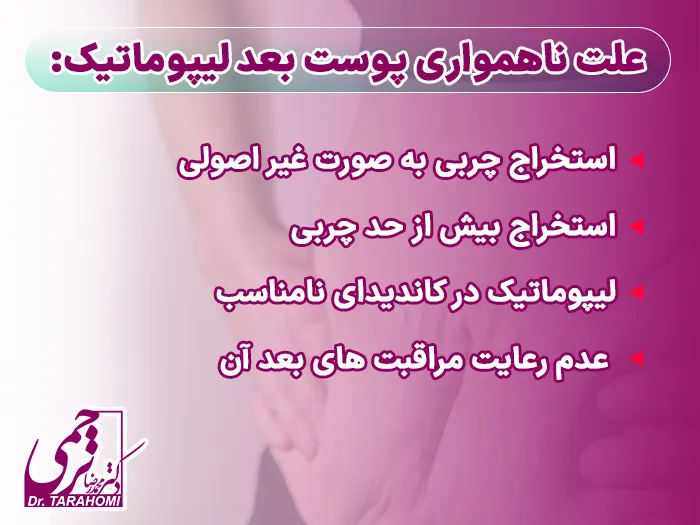 ناهمواری پوست بعد لیپوماتیک