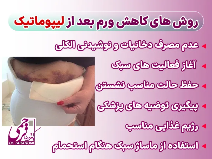 ورم بعد از لیپوماتیک