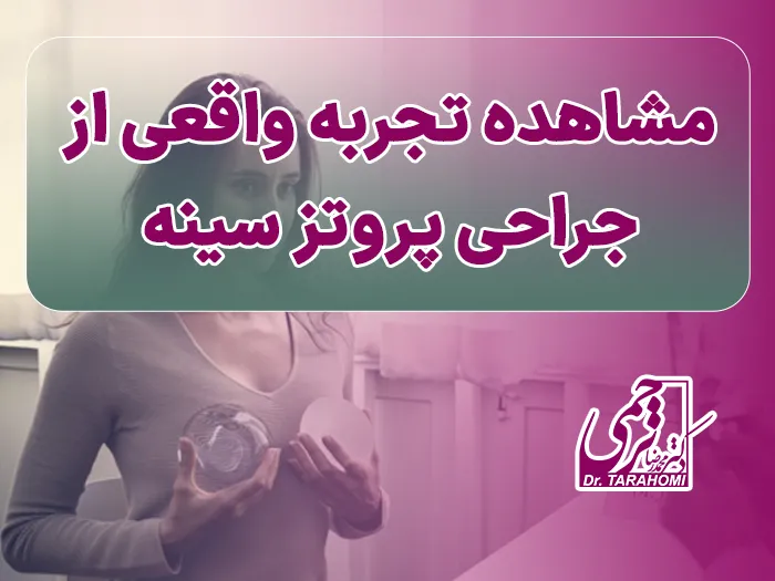 تجربه عمل پروتز سینه
