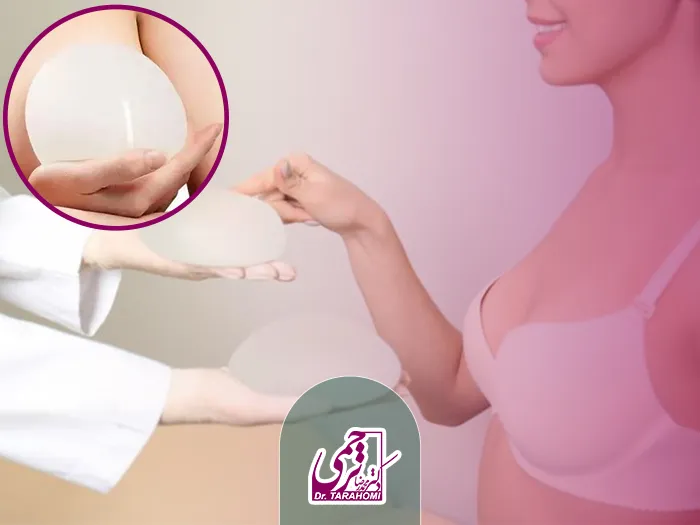 پروتز دائمی سینه