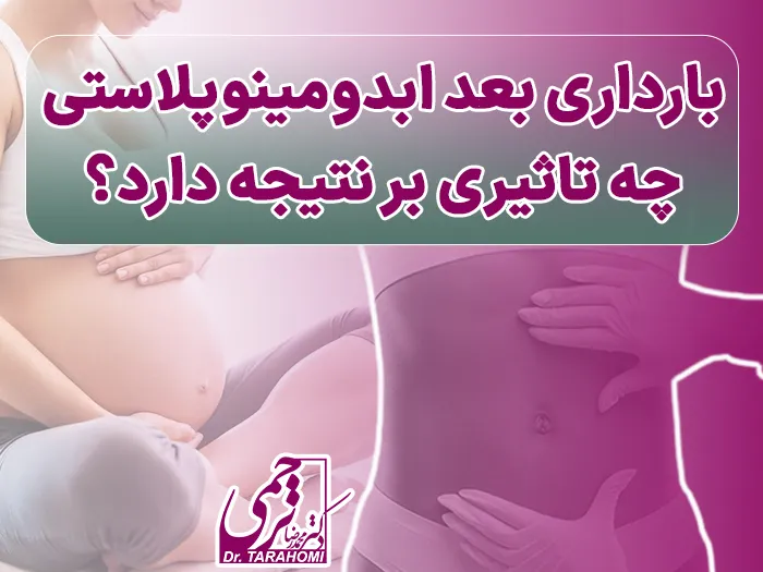 بارداری بعد ابدومینوپلاستی