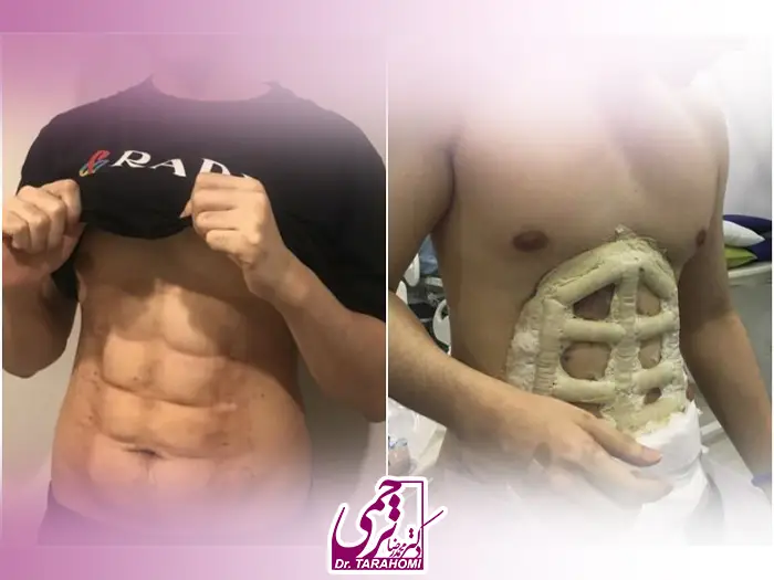 عمل سیکس پک