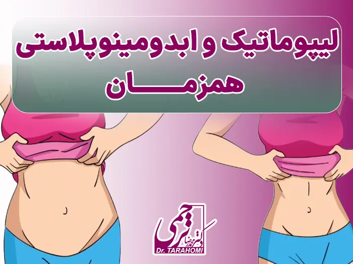 عمل لیپو ابدو