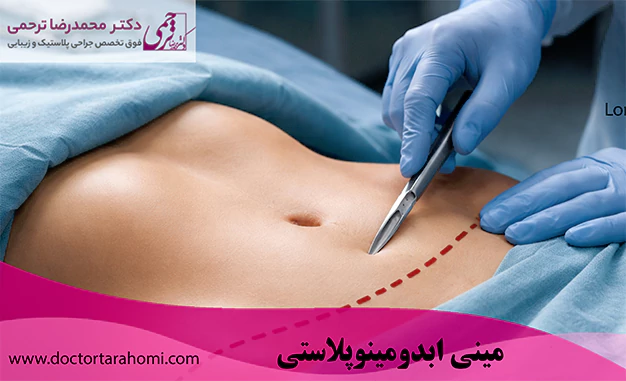عمل مینی ابدومینوپلاستی