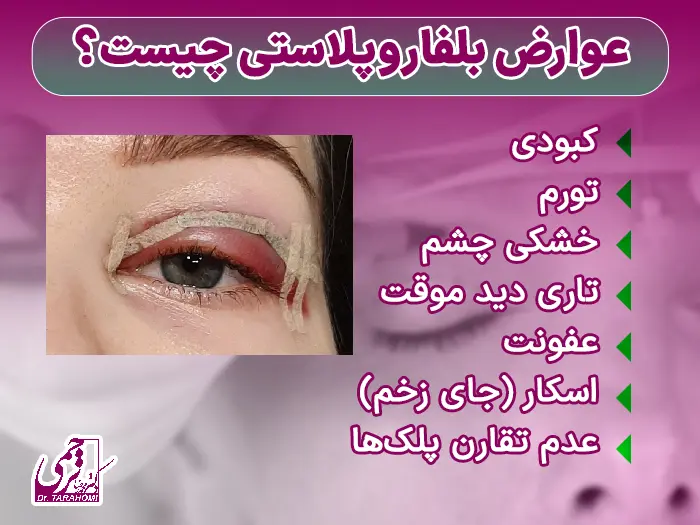 خطرات بلفاروپلاستی