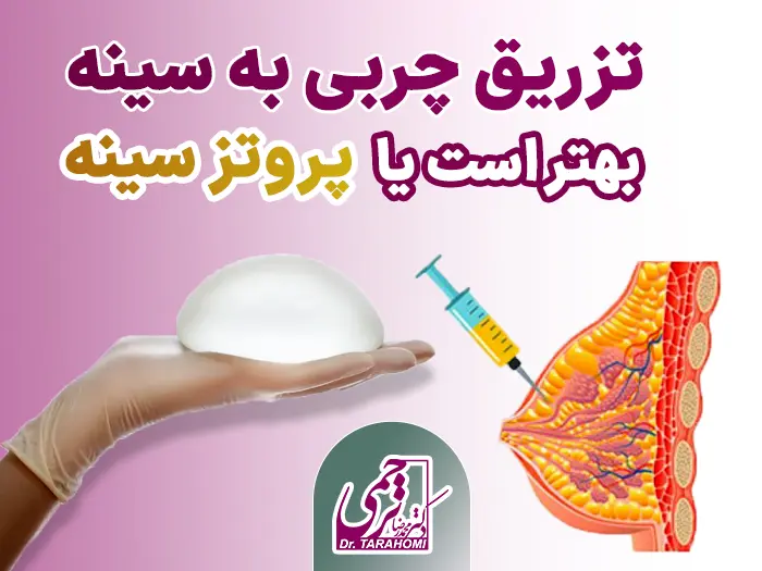 پروتز یا تزریق چربی