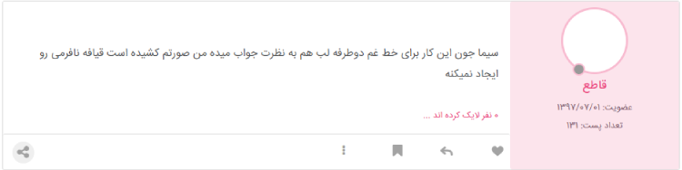 تجربه مینی لیفت صورت