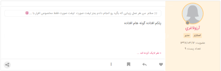 نظرات مینی لیفت صورت