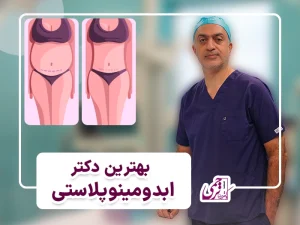 بهترین دکتر ابدومینوپلاستی