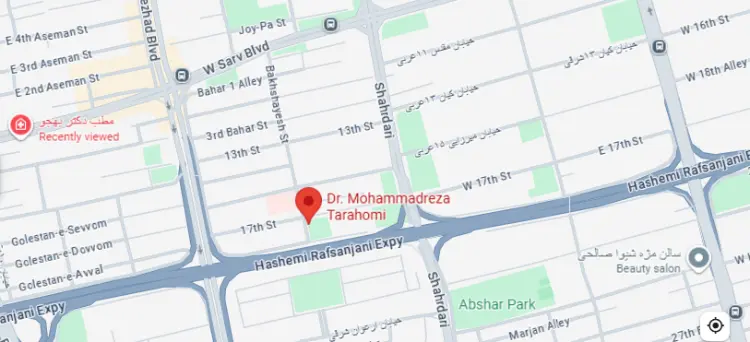 آدرس و شماره بهترین دکتر بلفاروپلاستی