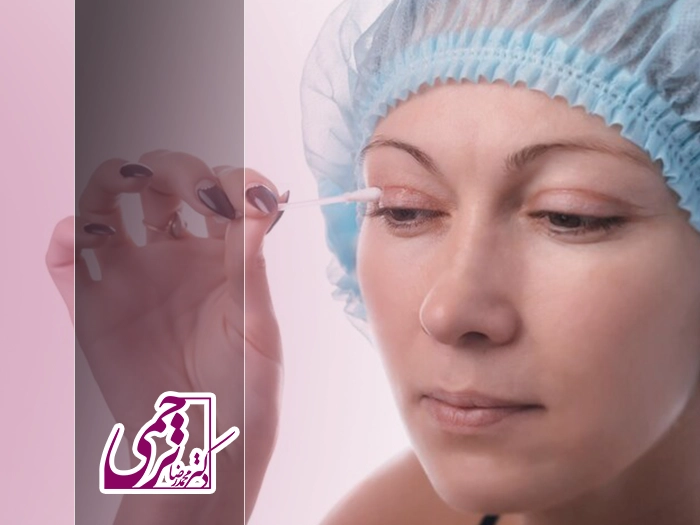 جای بخیه بلفاروپلاستی