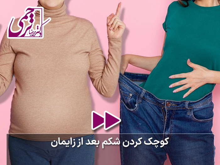 نحوه کوچک کردن شکم بعد زایمان