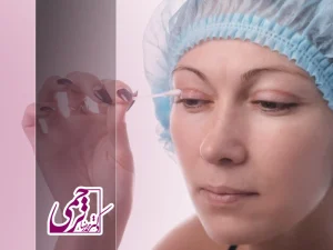 جای بخیه بلفاروپلاستی