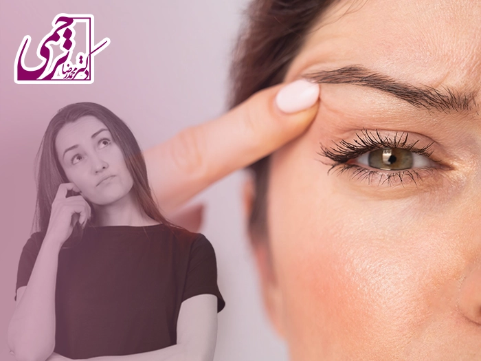 سن بلفاروپلاستی