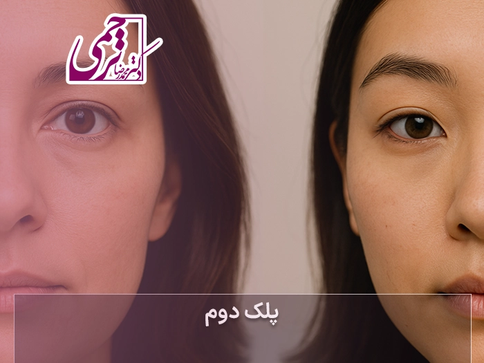 پلک دوتایی