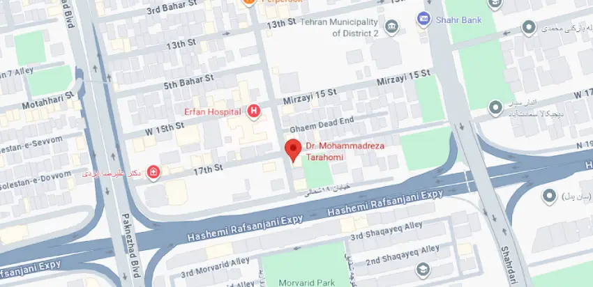 آدرس بهترین جراح ماموپلاستی