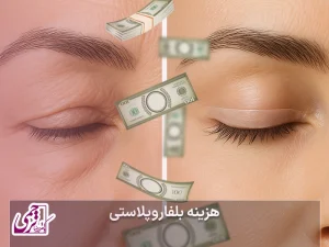 قیمت بلفاروپلاستی