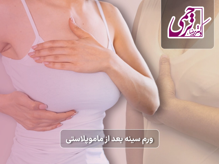 ورم سینه بعد ماموپلاستی