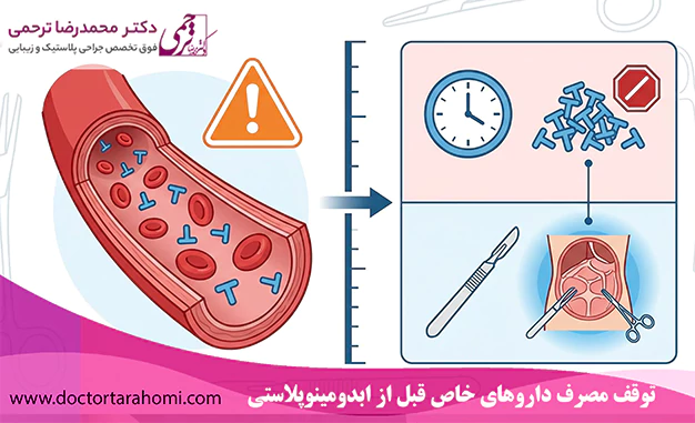 توقف مصرف داروهای خاص قبل از ابدومینوپلاستی توقف مصرف داروهای خاص قبل از ابدومینوپلاستی