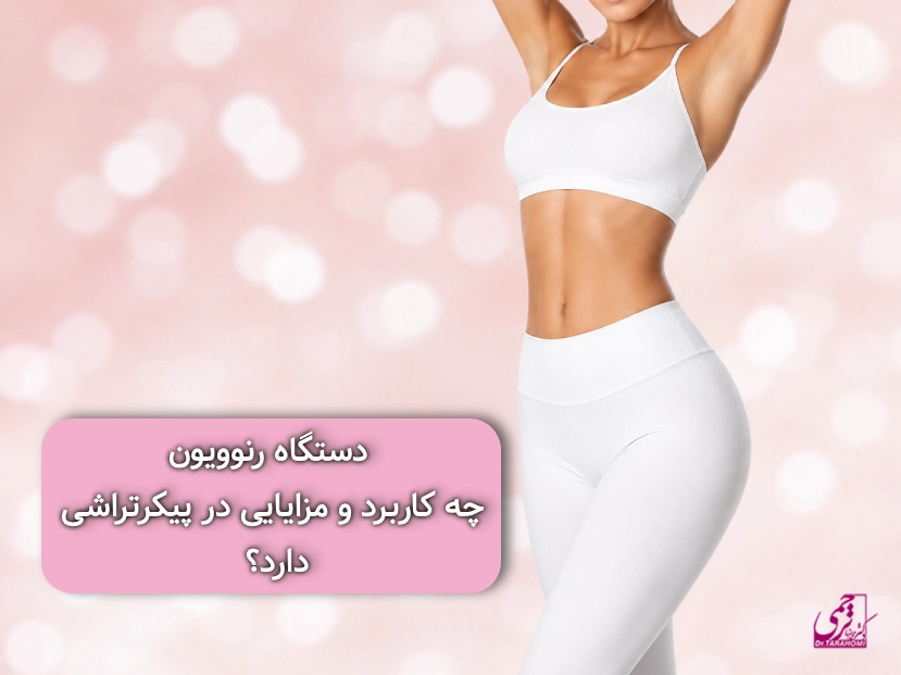 پیکرتراشی با رنوویون