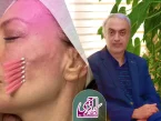 بهترین دکتر لیفت صورت